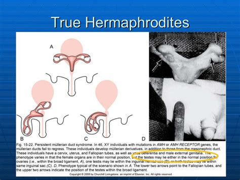 Hermaphrodite Dyke Surpises black female With Her trunk Clit 3 years ago 17:24 HDSex hermaphrodite, clit; Hermaphrodite Shoots Biggest CUM LOAD You've Ever Seen 1 year ago 02:51 TrannyOne hermaphrodite, sport; Hermaphroditism Selfsuck and Phat Selffacial! 3 years ago 04:12 KeekAss hermaphrodite, selfsuck; Hermaphrodite creampie